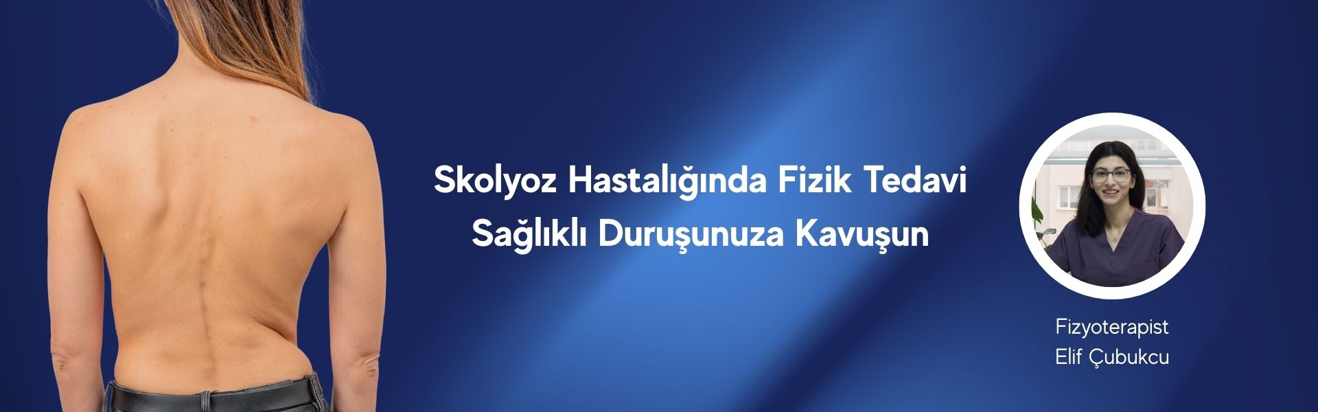 Skolyoz Hastalığında Fizik Tedavi