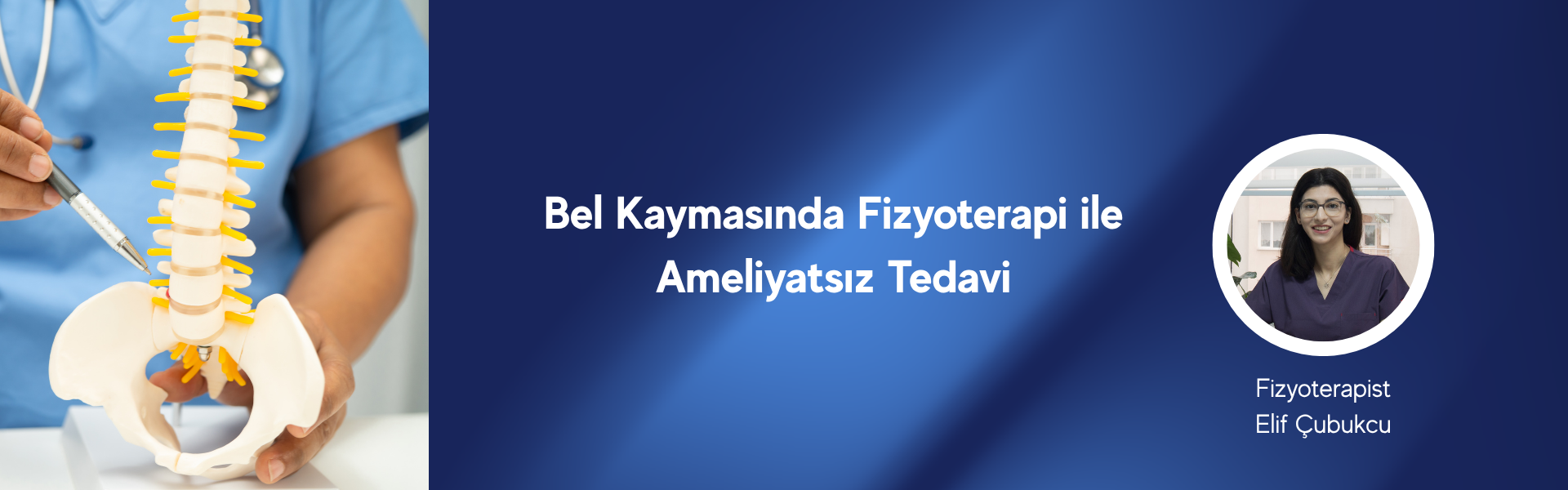 bel kayması ameliyatsız tedavi